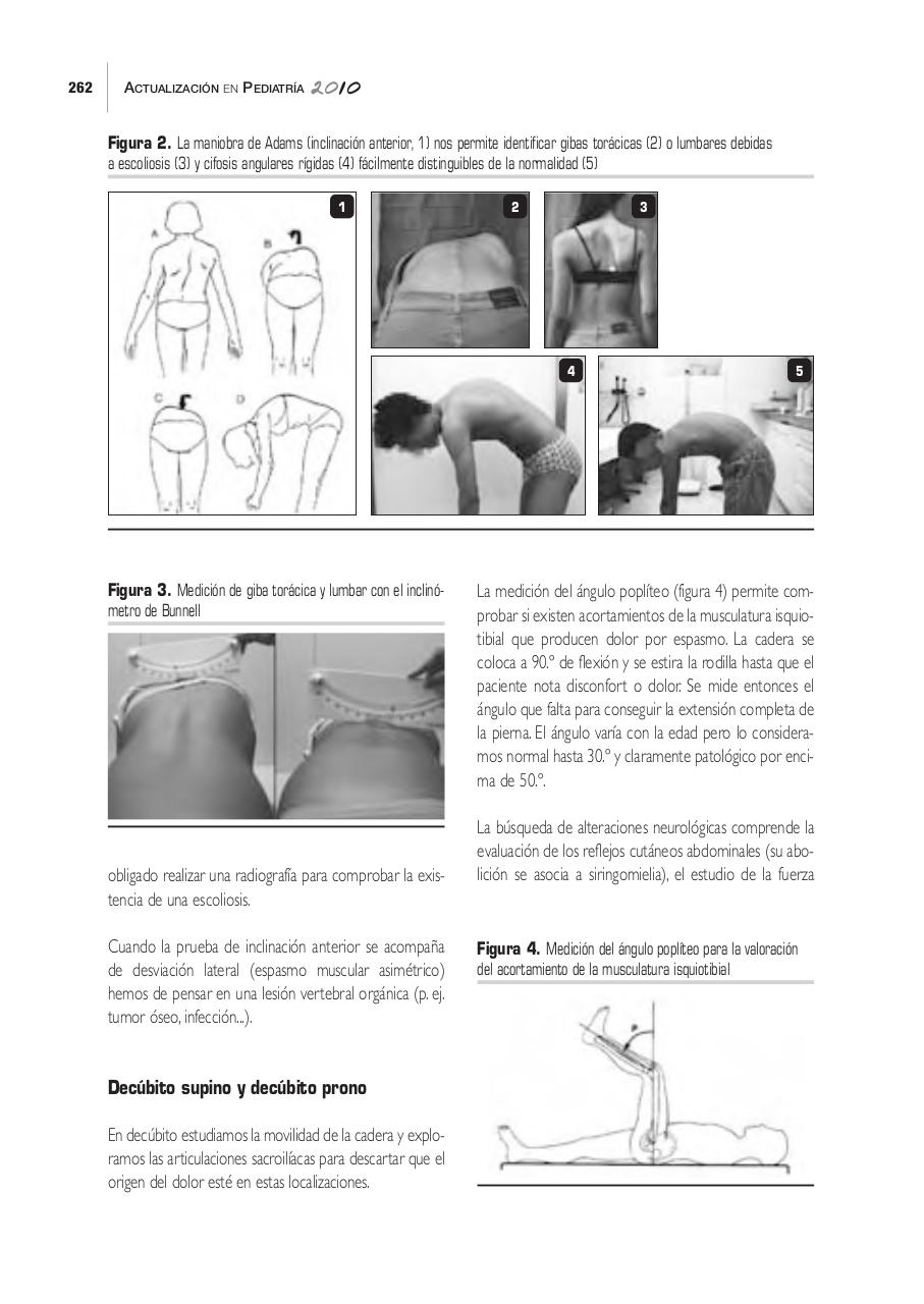 Vista previa del archivo PDF 16022016063753-dolor-espalda-infantil.pdf