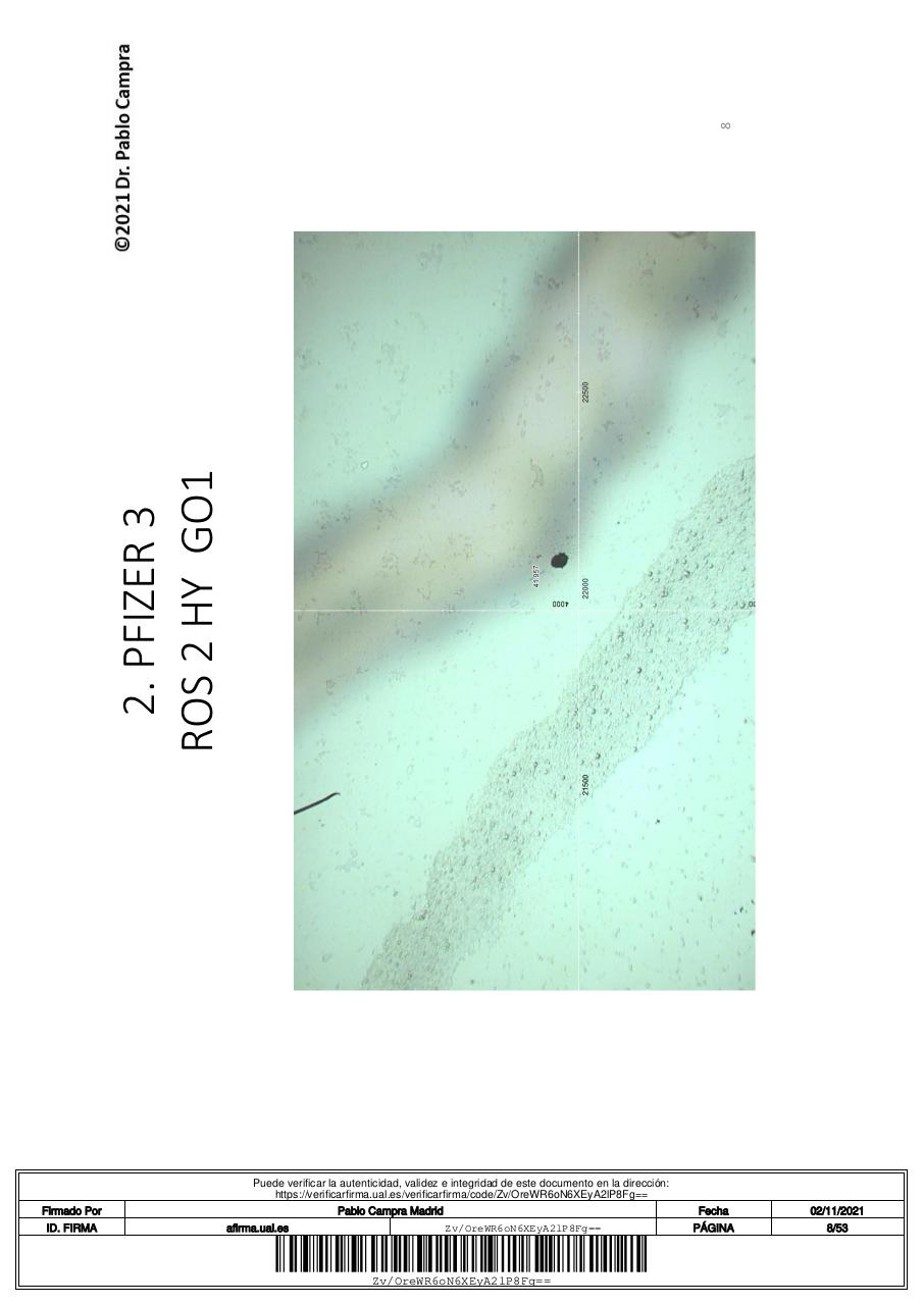 Vista previa del archivo PDF 1informetcnicofinaldeteccindegrafenoenvacunascovid.pdf